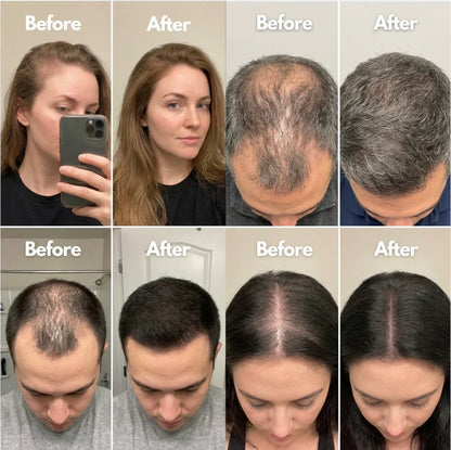 NewPlum 01: Follicle Regrowth Roll-On