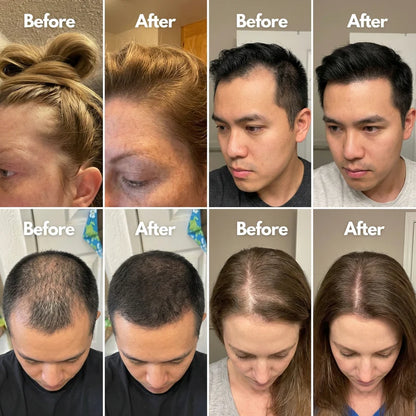 NewPlum 01: Follicle Regrowth Roll-On