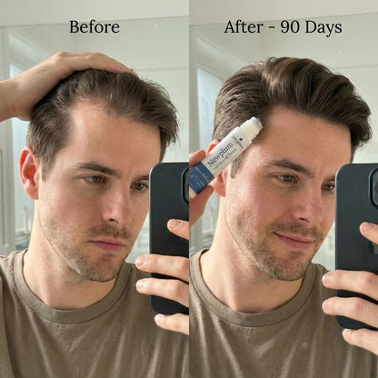 NewPlum 01: Follicle Regrowth Roll-On